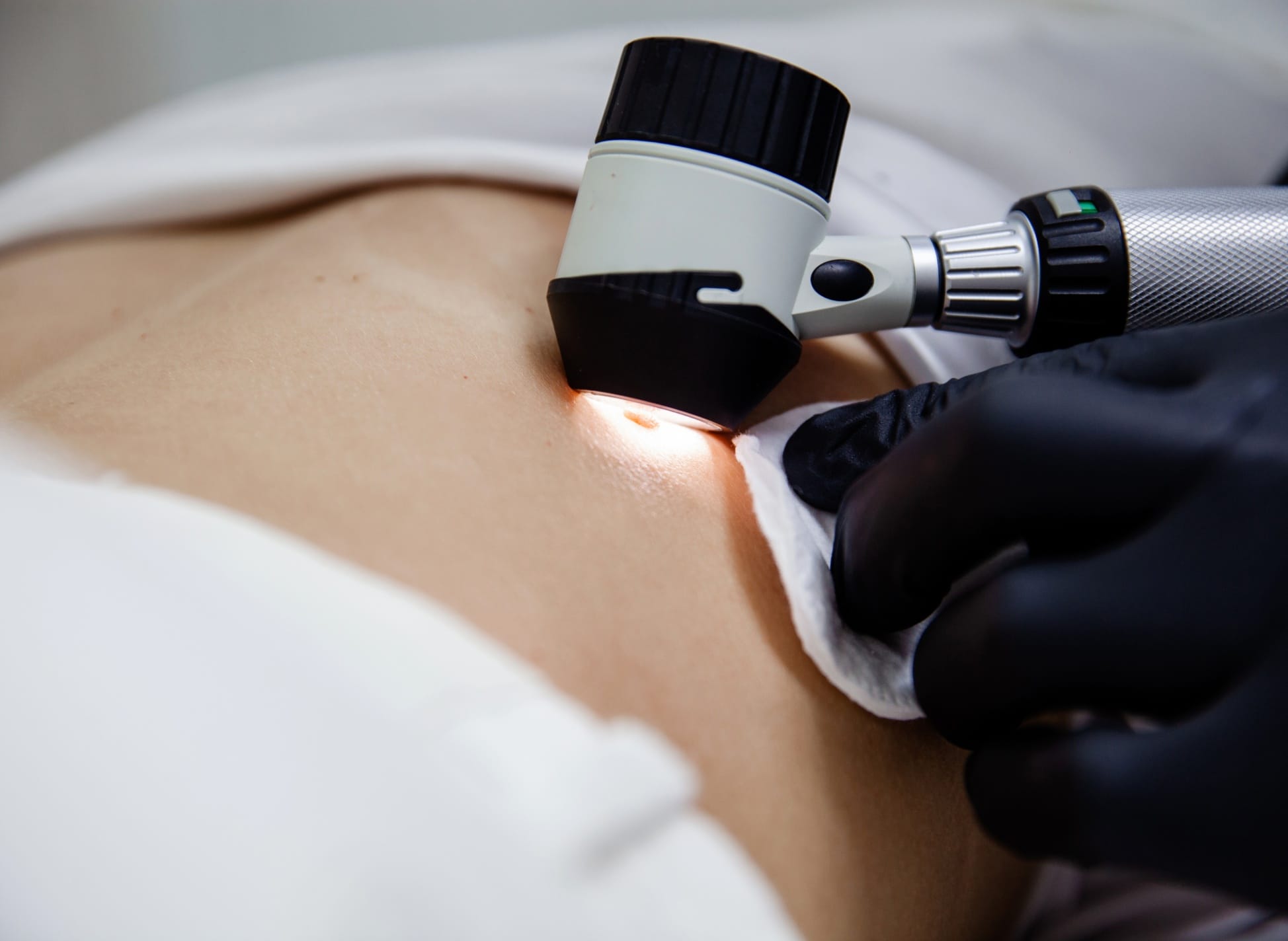 Parcours patient, Chirurgie dermatologique, médecin utilisant un dermatoscope | Maison Abeille