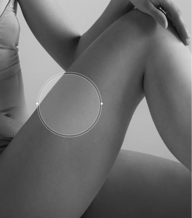 Photo rapprochee des cuisses d une jeune femme epilation laser | Maison abeille esthetique Paris